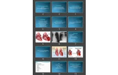 پاورپوینت Cardiomyopathies