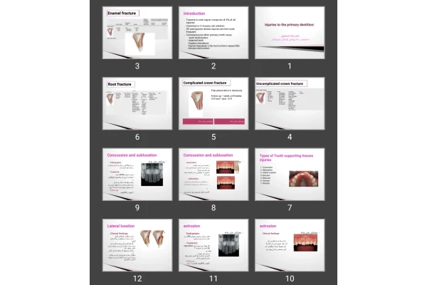 پاورپوینت Injuries to the primary dentition