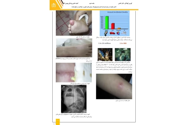 جزوه کنترل عفونت در بیمارستان ها و کنترل اپیدمیولوژیک بیماری های عفونی در کودکان در سطح جامعه