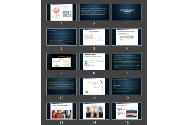 پاورپوینت Antiphospholipid syndrome