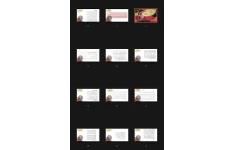 جزوه هیپرآندروژنمی و سندرم تخمدان پلی کیستیک