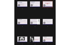 جزوه Spondyloarthritis (SPA)