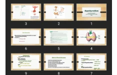 پاورپوینت Hypothyroidism