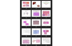 پاورپوینت  Liver and Biliary Tract Pathology Robbins Basic Pathology