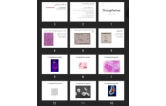 پاورپوینت Toxoplasma