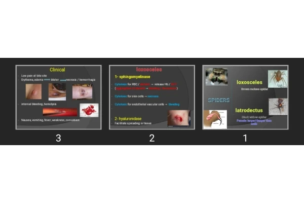 پاورپوینت Spider