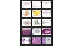 پاورپوینت Diseases of white blood cells, lymph nodes ,spleen and thymus