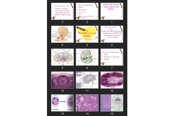 پاورپوینت Diseases of white blood cells, lymph nodes ,spleen and thymus