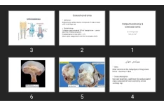 پاورپوینت Osteochondroma & osteosarcoma
