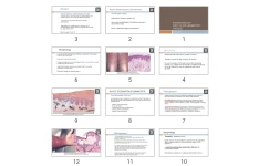پاورپوینت skin Pathology Part 2-2 (Inflammatory disease)