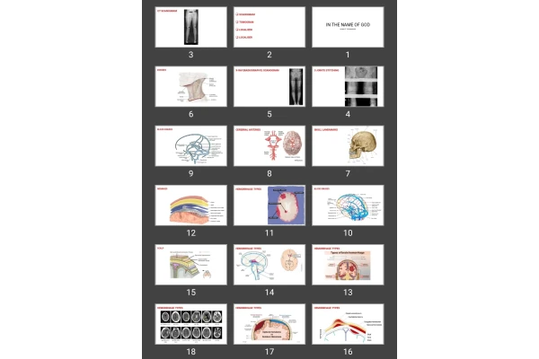 پاورپوینت HEAD CT TECHNIQUES