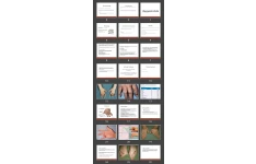 پاورپوینت Rheumatoid Arthritis