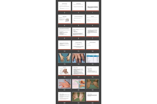 پاورپوینت Rheumatoid Arthritis