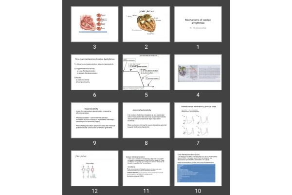 پاورپوینت Mechanisms of cardiac arrhythmias