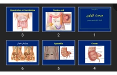 پاورپوینت مبحث کولون