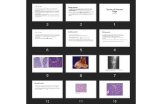 پاورپوینت Tumors of Unknown Origin