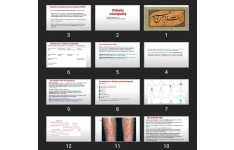 پاورپوینت Diabetic neuropathy