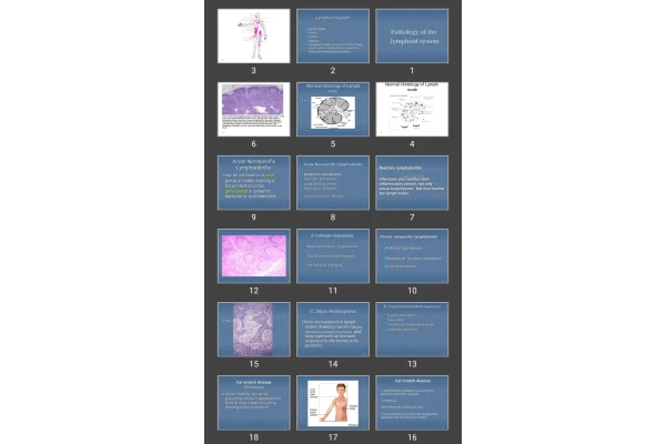 پاورپوینت Pathology of the lymphoid system