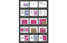 پاورپوینت Peripheral Nerves and Muscles