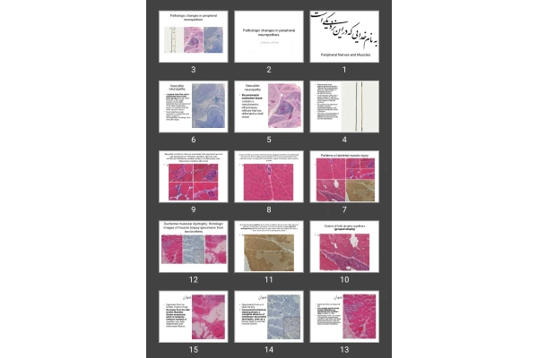 پاورپوینت Peripheral Nerves and Muscles