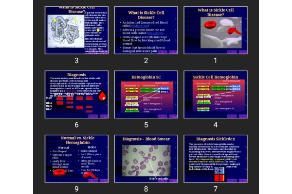 پاورپوینت What is Sickle Cell Disease
