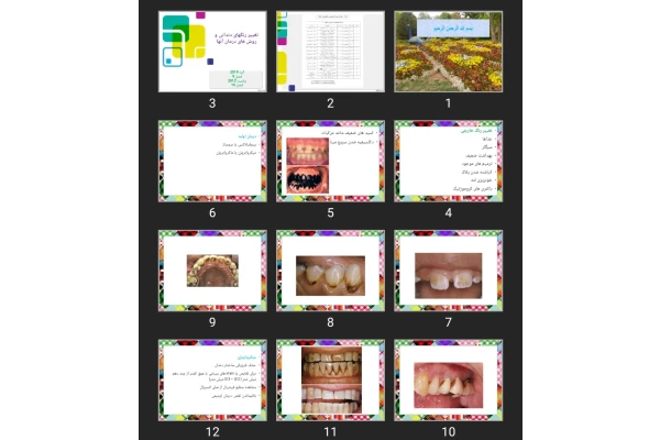 پاورپوینت تغییر رنگ های دندانی و روش های درمان آنها