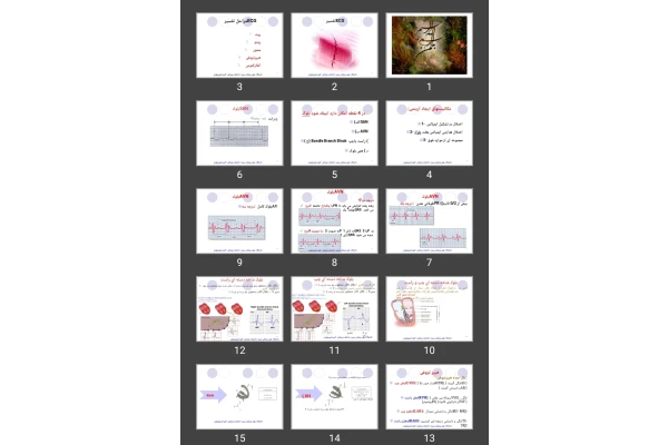 پاورپوینت تفسیر ECG