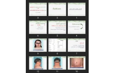 پاورپوینت سندرم كوشينگ
