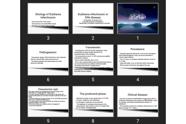 پاورپوینت Erythema infectiosum or fifth disease