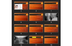 پاورپوینت اختلالات تنفسی