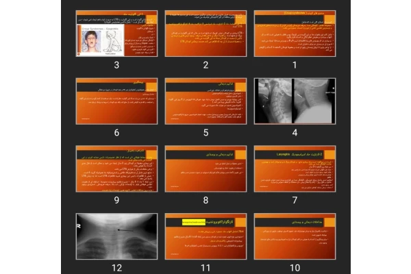 پاورپوینت اختلالات تنفسی