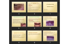 پاورپوینت Epithelial lesions 6