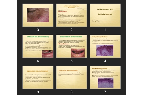 پاورپوینت Epithelial lesions 6
