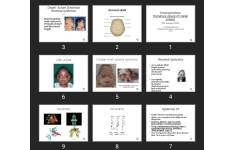 پاورپوینت Craniosynostosis Premature closure of cranial sutures