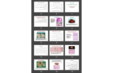 پاورپوینت Liver and Biliary Tract Tumors