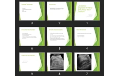پاورپوینت Laboratory Diagnosis of Kidney and Urinary Tract Diseases