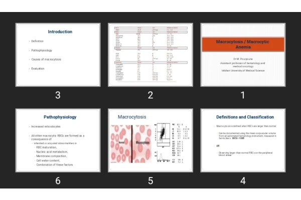 پاورپوینت آنمی ماکروسیتیک Macrocytosis / Macrocytic Anemia