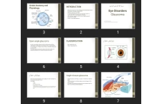 پاورپوینت Eye Disorders Glaucoma