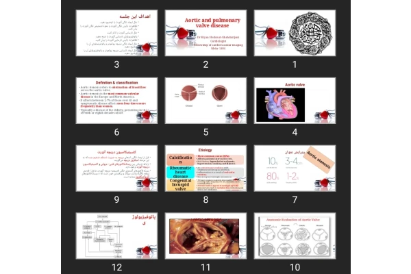 پاورپوینت Aortic and pulmonary valve disease