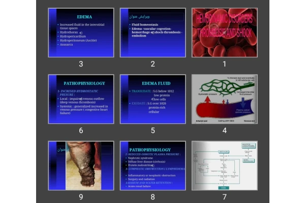 پاورپوینت HEMODINAMIC DISORDERSTHROMBOSIS AND SHOCK