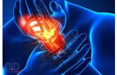   پاورپوینت التهاب inflammation