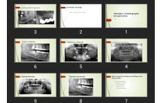 پاورپوینت Principles of Radiographic Interpretation