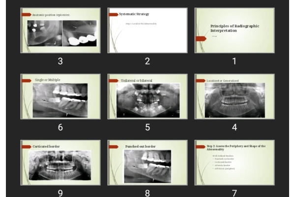 پاورپوینت Principles of Radiographic Interpretation