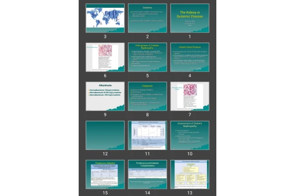 پاورپوینت The Kidney in Systemic Disease