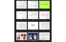 پاورپوینت ARDS