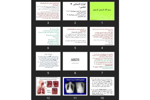 پاورپوینت ARDS