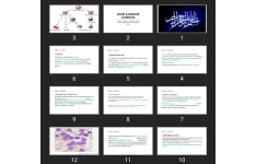 پاورپوینت Acute Lymphoid Leukemia