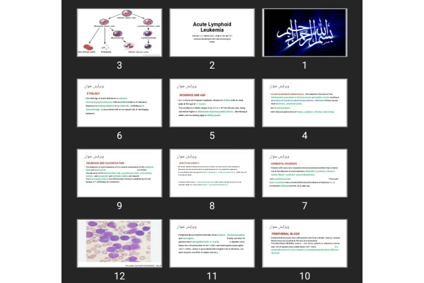 پاورپوینت Acute Lymphoid Leukemia