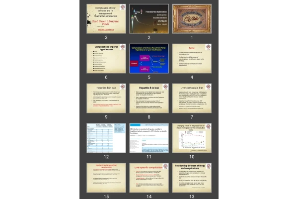 پاورپوینت Complication of liver cirrhosis and its management. The Iranian perspective