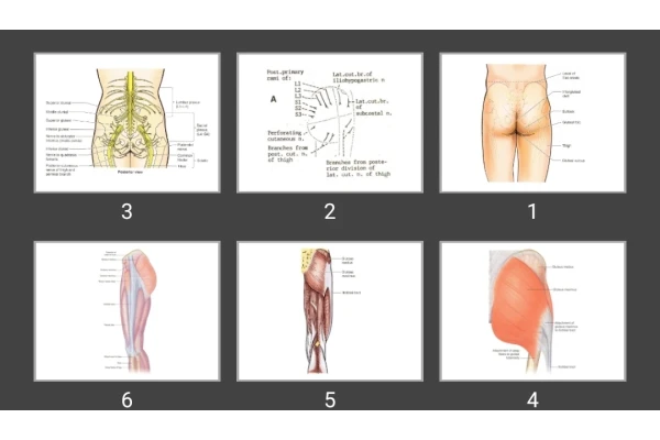 پاورپوینت ناحیه گلوتئال و عقب ران